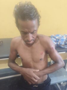 गोमर्दा अभ्यारण्य क्षेत्र में भालू का हमला, शौच के लिए गए ग्रामीण को किया घायल; वन विभाग ने तत्काल पहुंचकर दी सहायता राशि